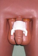 c3clamp