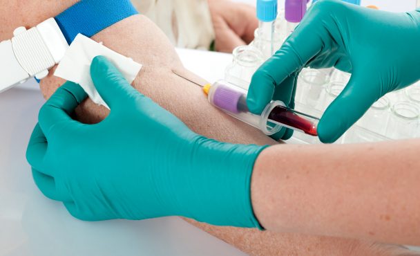Why do the APS test?