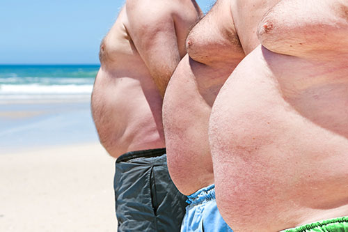 obésité et cancer de la prostate