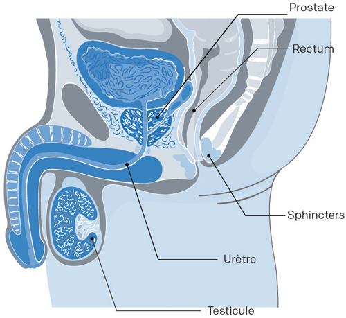 Illustration de l’appareil de l’homme pour un cancer prostate