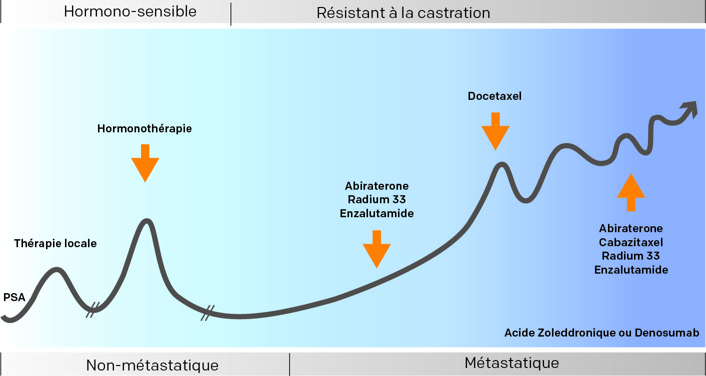 Illustration des traitements selon l'évolution d'un cancer prostate