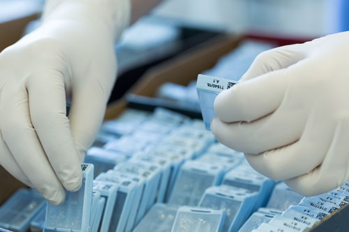 essais cliniques selon l'évolution d'un cancer prostate
