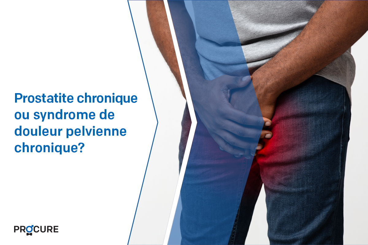 Prostatite chronique ou syndrome de douleur pelvienne chronique?
