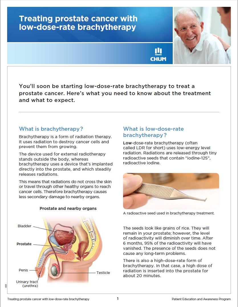 Curiethérapie-bas-débit-ou-permanent-cancer-prostate