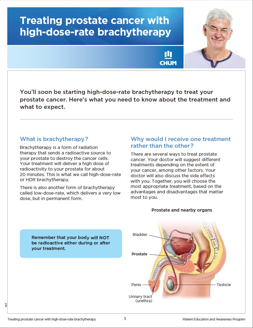 Curiethérapie-haut-débit-cancer-prostate