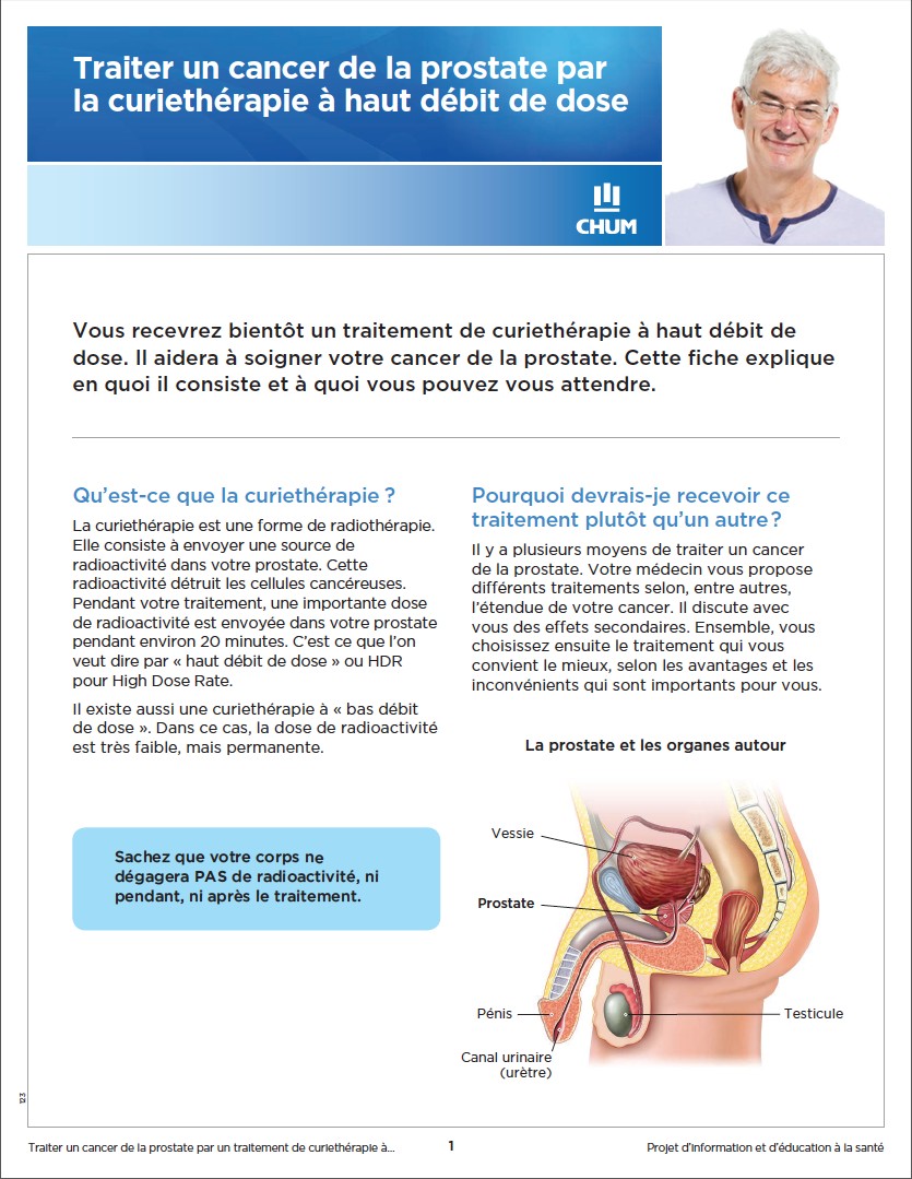 Curiethérapie-haut-débit-cancer-prostate