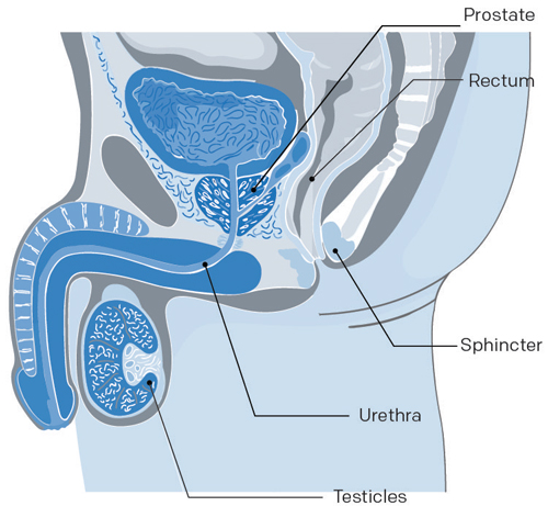 Illustration de l’appareil de l’homme pour un cancer prostate