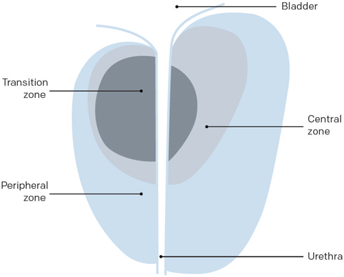 Illustration des 3 zones de la prostate de l’homme cancer prostate