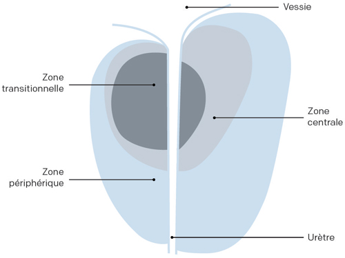 Illustration des 3 zones de la prostate de l’homme cancer prostate