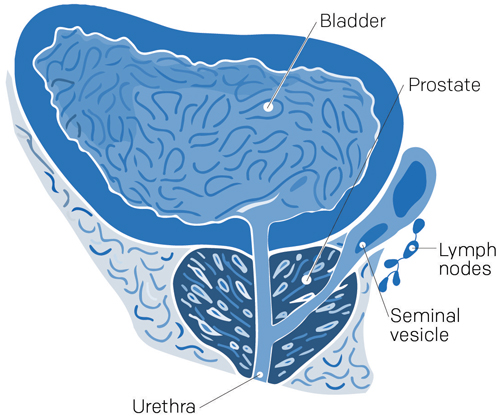 Illustration d’une prostate saine cancer prostate